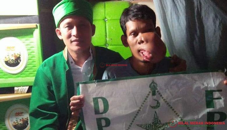 Ustadz Azanul Shauty selaku Ketua DPW FPI Deli Serdang (kiri) saat menjenguk Ahmad Safri