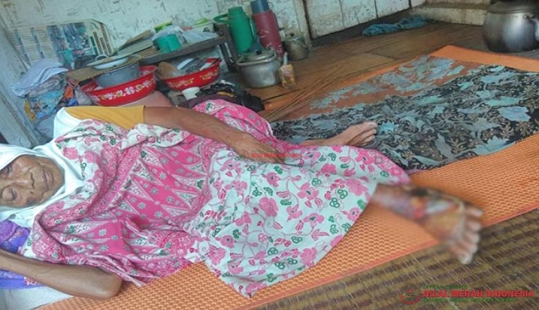 Mak Ici, wanita lansia yang kakinya menderita infeksi kulit pada kakinya berharap ada donatur yang membantu memulihkan penyakit yang dialaminya