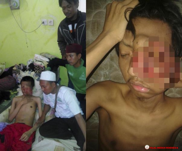 Kondisi Ahmad Faisal Husen (21 tahun) penderita tumor stadium 4, saat dikunjungi para laskar DPC FPI Tambun Utara