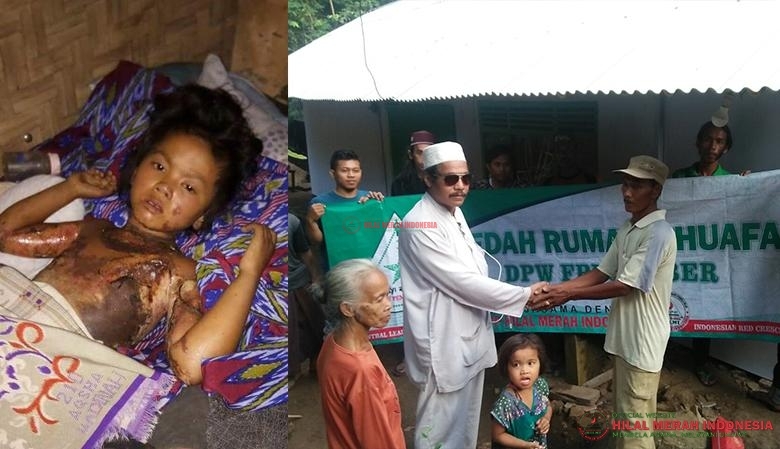 Kondisi Alda (kiri), (insert) proses serah terima rumah oleh DPW FPI Jember kepada Pak Misdin (kanan).