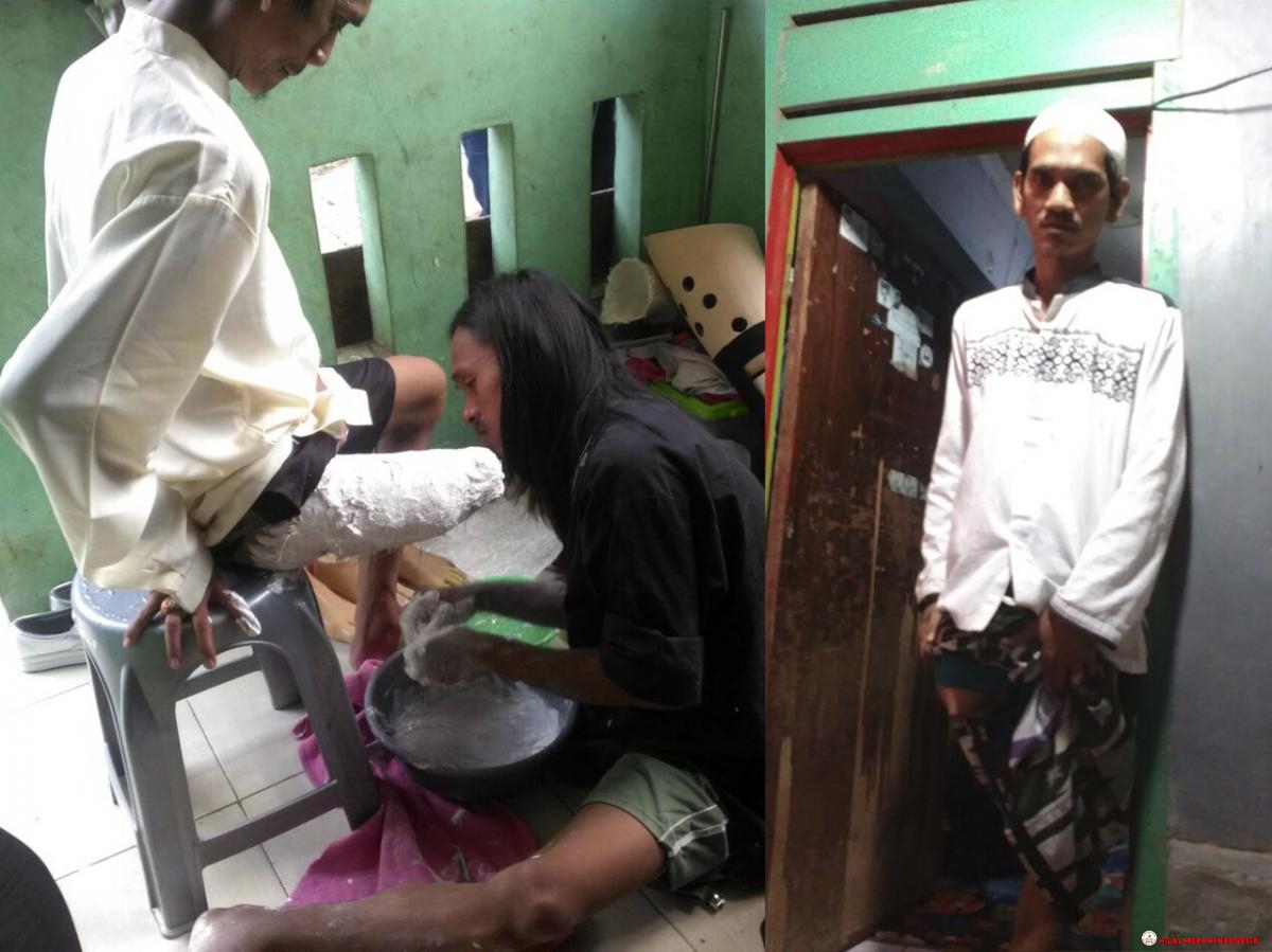 Pak Slamet saat pengukuran pembuatan kaki palsu yang ditangani oleh Ronal.