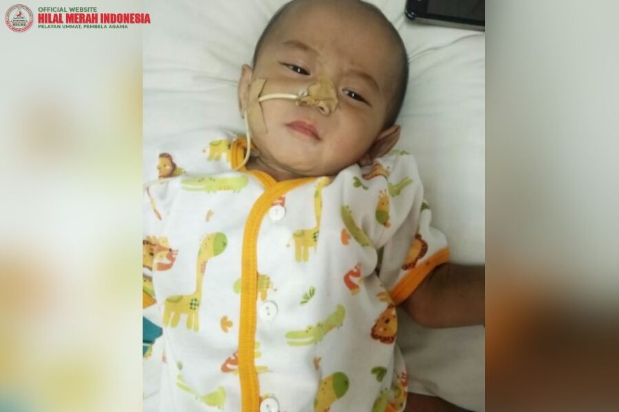 Derita Tamjid Si Bayi Penderita Penyakit Langka