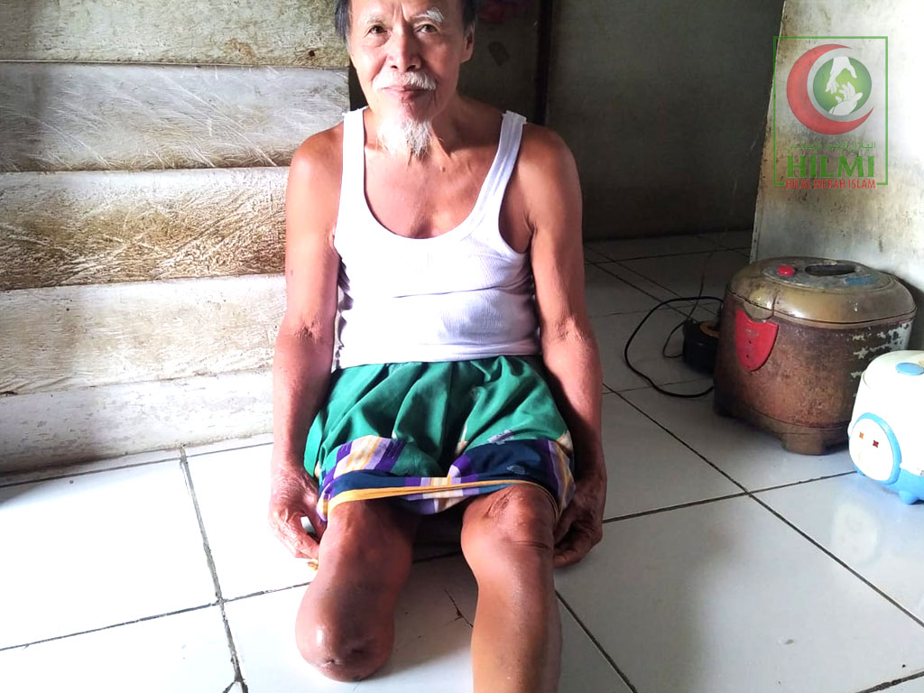 Menjelang Iedul Fitri, DPP HILMI-PRI-FPI Hadiahkan Kaki Palsu Untuk Penyandang Disabilitas
