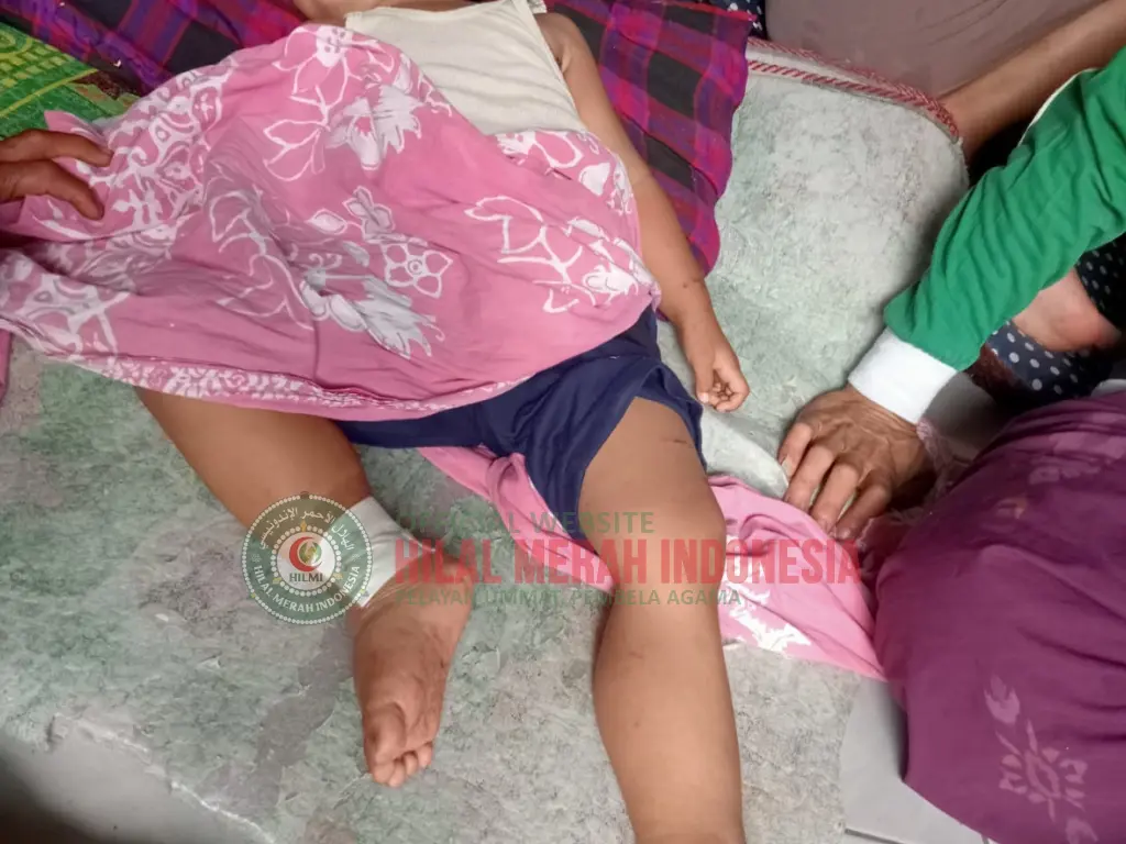 Korban Musibah Tertimpa Pohon