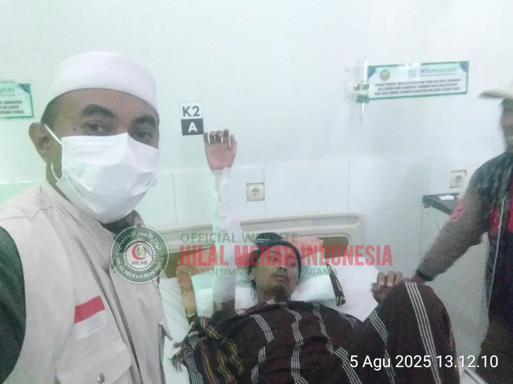 Hilmi Bantu Pasien Luka Bakar 2