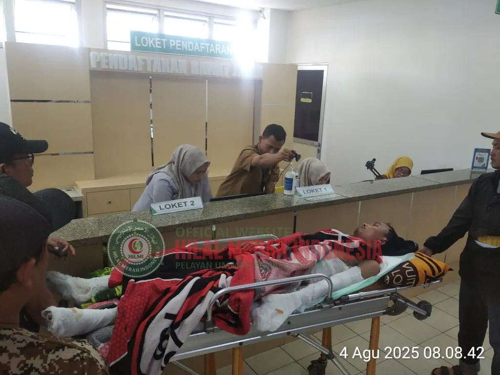 Hilmi Bantu Pasien Luka Bakar