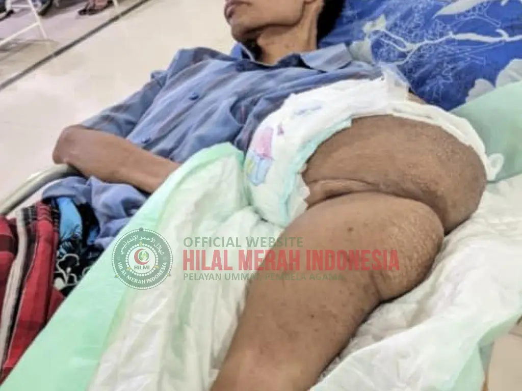 Relawan HILMI Ciamis Bergerak Malam Hari Demi Selamatkan Pasien Tumor